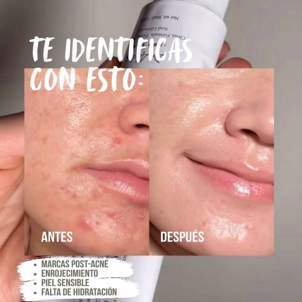 Dr. Althea 345. 🌿 Crema calmante que ayuda a reducir irritación, controlar grasa y mejorar manchas del acné.