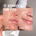 Dr. Althea 345. 🌿 Crema calmante que ayuda a reducir irritación, controlar grasa y mejorar manchas del acné.